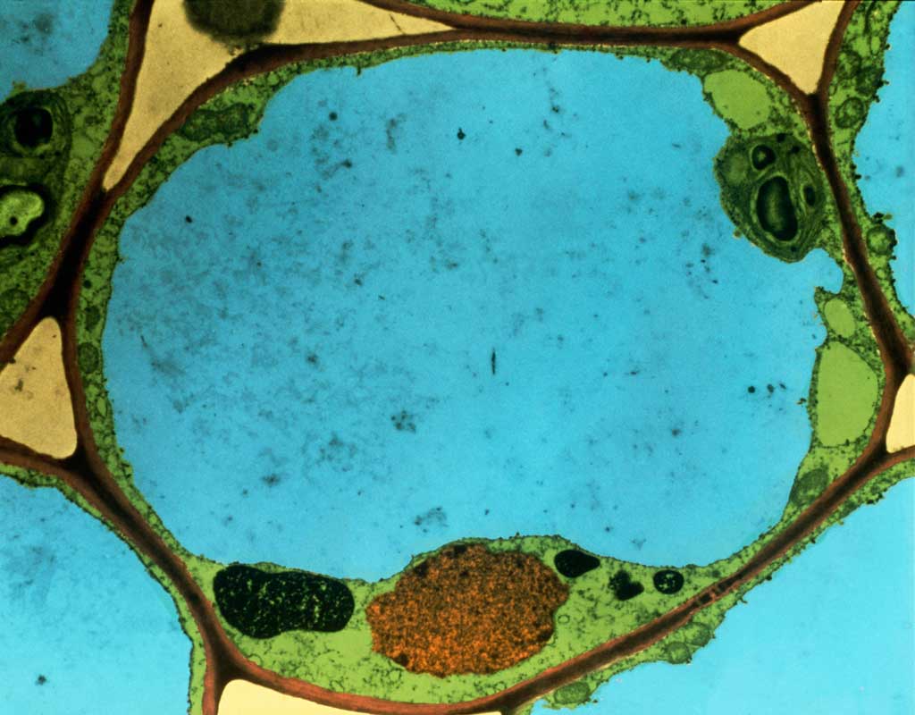 строение раст клетки под микроскопом фото 94